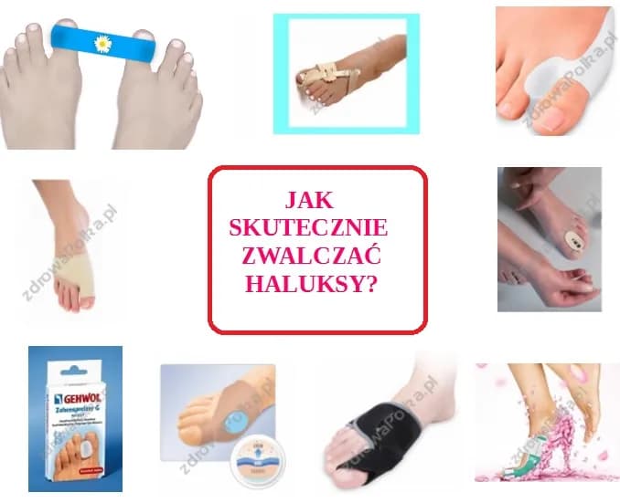 Kompleksowy przewodnik: Jak wyprostować haluksy i zapobiegać?