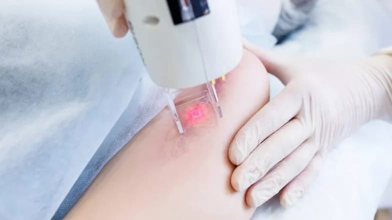 Laseroterapia: Odkryj, jak leczy ból i przyspiesza regenerację!