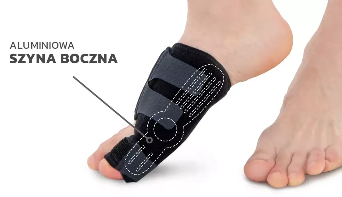 Ortezy na haluksy: Prawda o ich skuteczności. Co musisz wiedzieć?