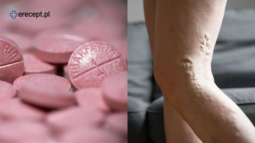 Leki rozrzedzające krew: Na receptę czy bez? Pełny przewodnik